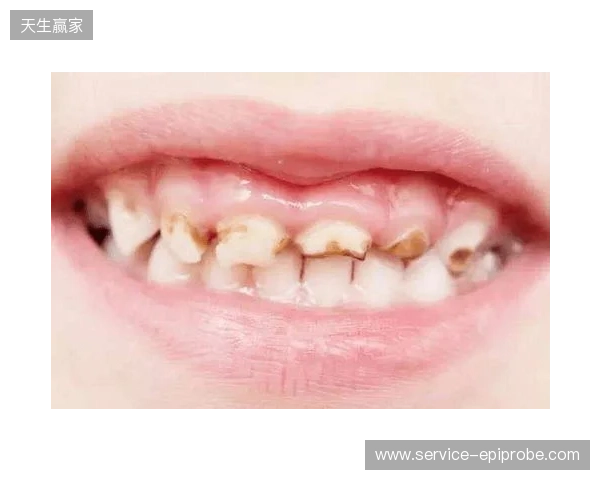 韦林顿确诊上唇部贯通伤；11、21牙半脱位；上颌前牙区牙槽骨骨折