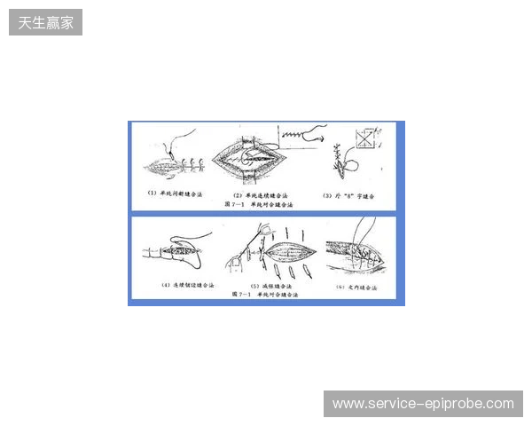 广州豹官方：杨浩眉弓伤口缝合30余针，预计5-7天后拆线